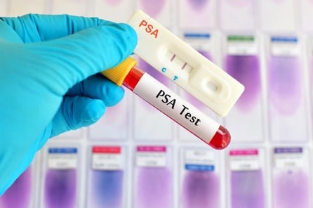 prueba de PSA